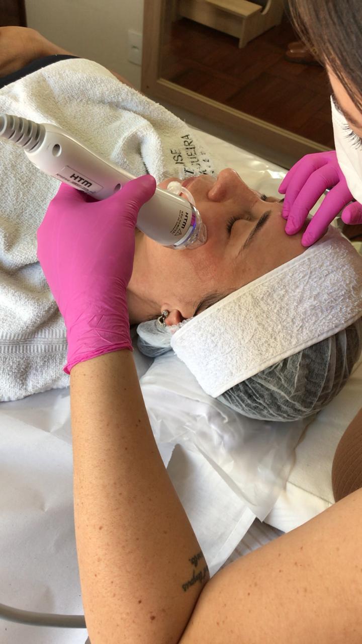 Benefícios do tratamento